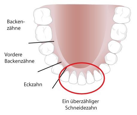 Zahnuberzahl Kitzortho Ddr Nikolaus Neunteufel Kitzbuhel