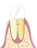 Körperliche Zahnbewegung
